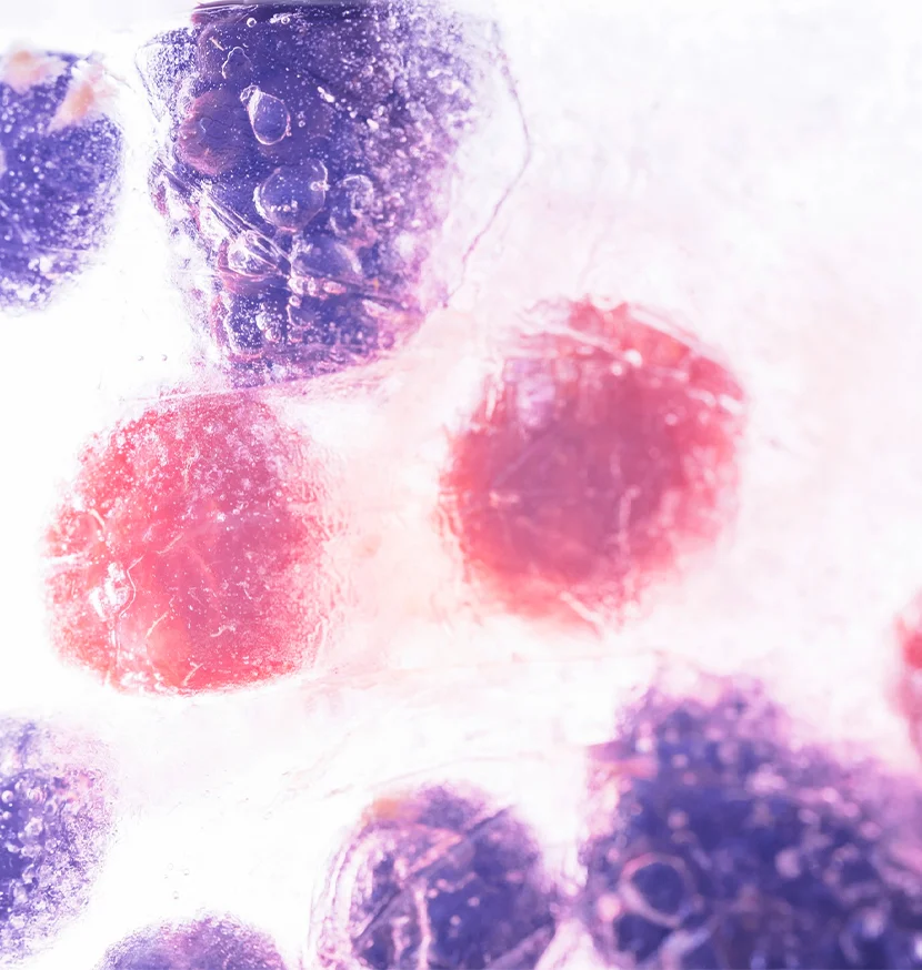 Hodgkin’s and Non-Hodgkin’s Lymphoma