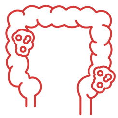 Colorectal Cancer