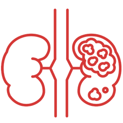 Wilms Tumor