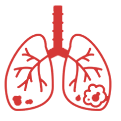 Lung Cancer
